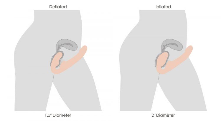 Perfect for penetrating a male or female body, this remote-c... Strap U - Remote Inflatable Ergo-Fit Strapless Strap-On - Flesh photo-5