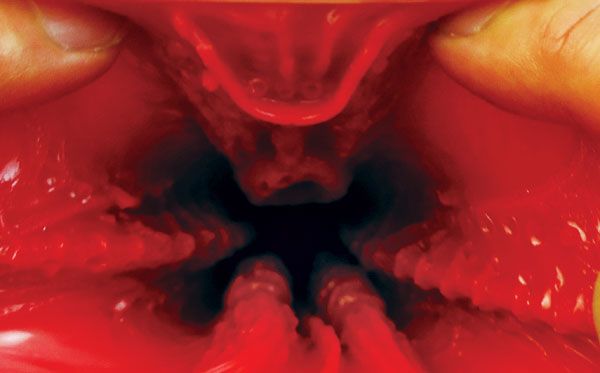 Maximize the performance of the uterus!
Those who like to b... A-One - Floor Oner Style Instruments Seeding Press - Hard photo-7
