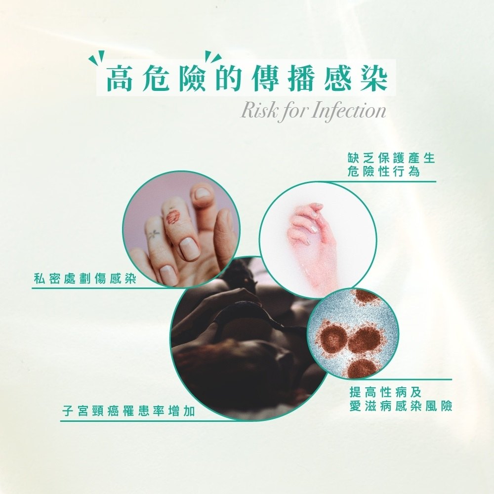 Play & Joy - Finger Condom Hyaluronic Acid 5's Pack photo-3