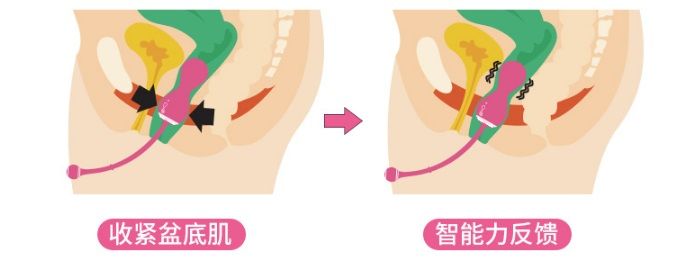 Magic Kegel Master Gen 2 for pelvic muscle recovery. Magneti... Magic Motion - Master Kegel Ball 2 - Pink photo-10