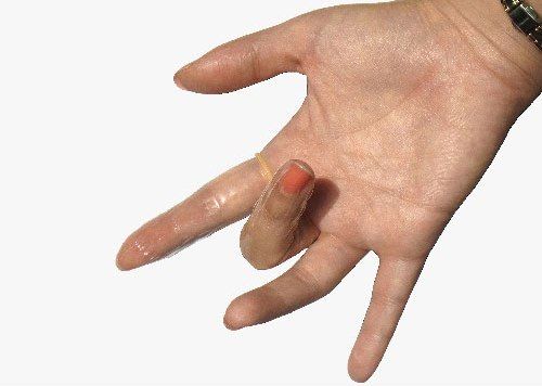 Findom - Latex Finger Condoms - 12's Pack photo