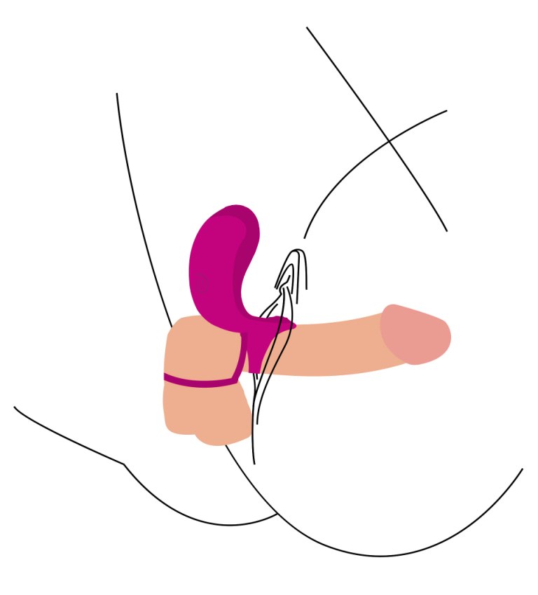 Xocoon - Couples Stimulator Ring - Purple photo-4