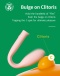 Monster Pub - Flex Egg  突突心跳蛋 穿戴式震動棒 照片-4