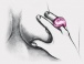 Gvibe - Gring 手指震動器 - 莓粉色 照片-9