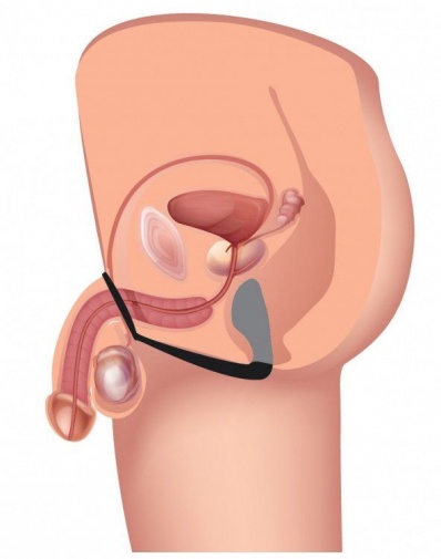 Prostatic Play - 前列腺刺激器与阴茎及睾丸环 - 黑色 照片