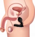 Prostatic Play - 充气式 12模式前列腺刺激器 - 黑色 照片-7